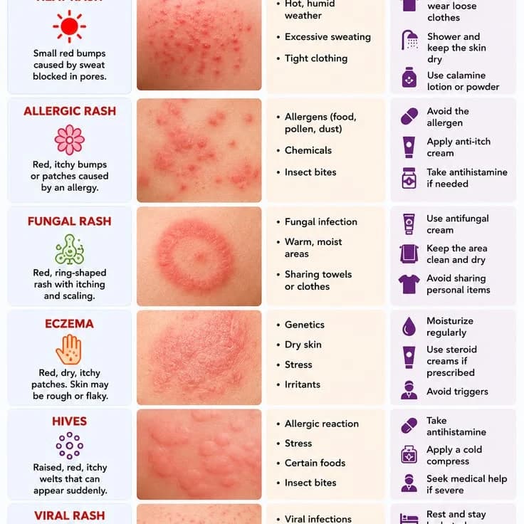Heat Rash Prevention During Hot Weather in Nigeria ☀️🥵
