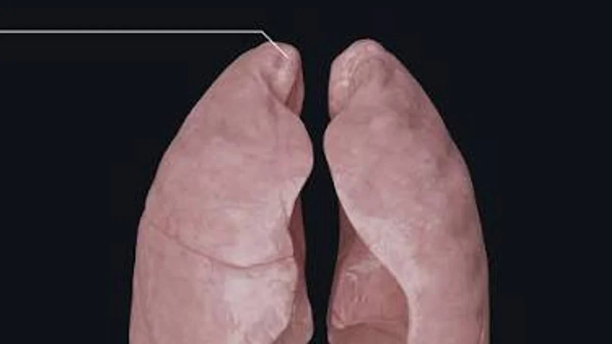 Your Lungs Don't Have Muscles to Pull Air In