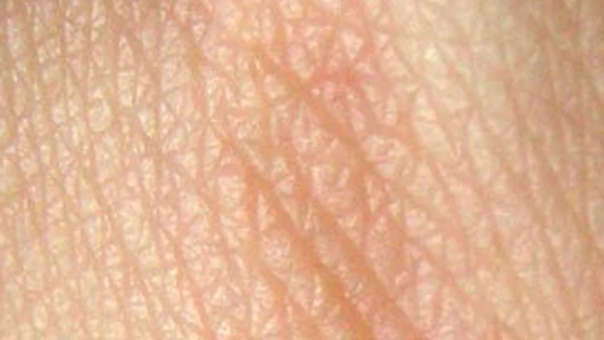 Your Skin Is a Living Shield 🛡️