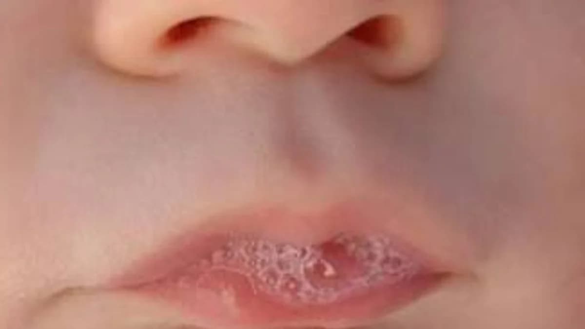 You Make a Lot of Saliva