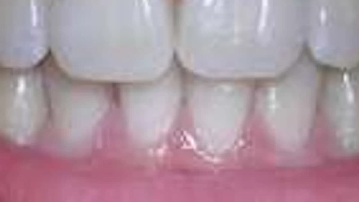 Your Teeth Can't Fix Themselves đڎ