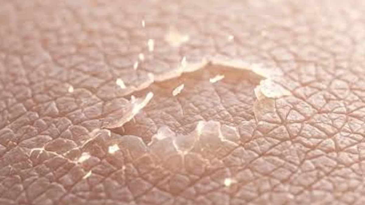 Your Skin Is Constantly Replacing Itself