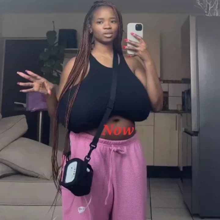 WOMAN LAMENT AS HER NORMAL-SIZED BREASTS GROW SUDDENLY AGAIN SHORTLY AFTER UNDERGOING REDUCTIONS OF SURGERY TACKLE SAME PROBLE...see more