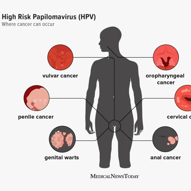 HPV: The Virus Many Women May Have Without Knowing