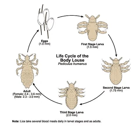 How I Got Rid of Head Lice Without Cutting My Hair