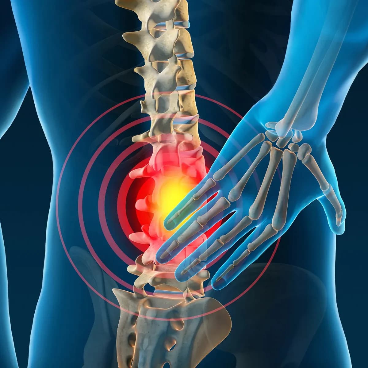 How your wallet can cause back pain