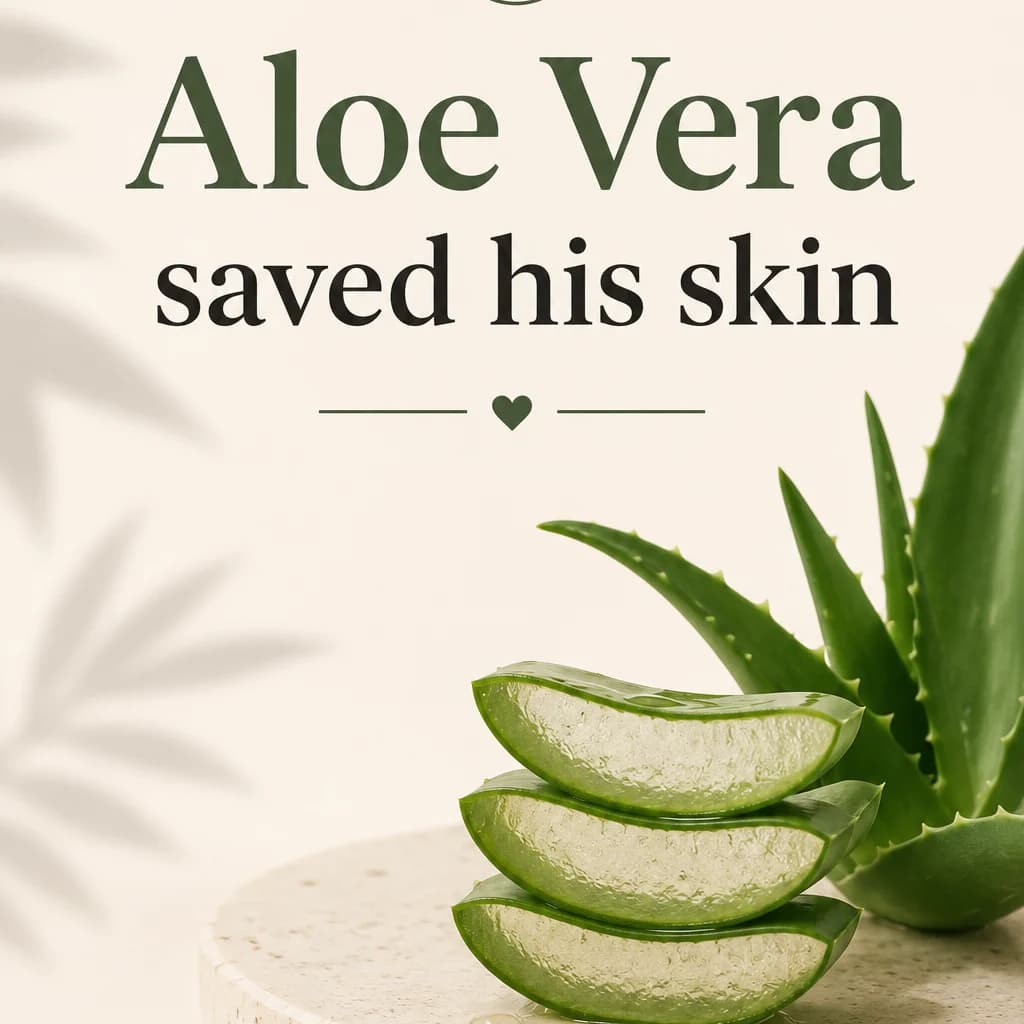 The Aloe Vera Gel I Almost Ignored Helped Save My Son’s Burned Skin