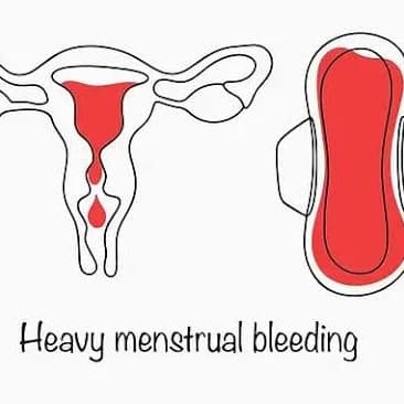 🩸 Is Your Period Too Heavy? Here's How to Tell 👇