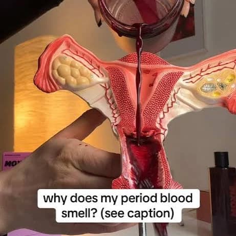 Why Does Your Period Smell Bad? Here's What You Should Know 👇