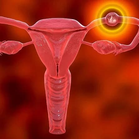A must read for everyone (Ectopic pregnancy)