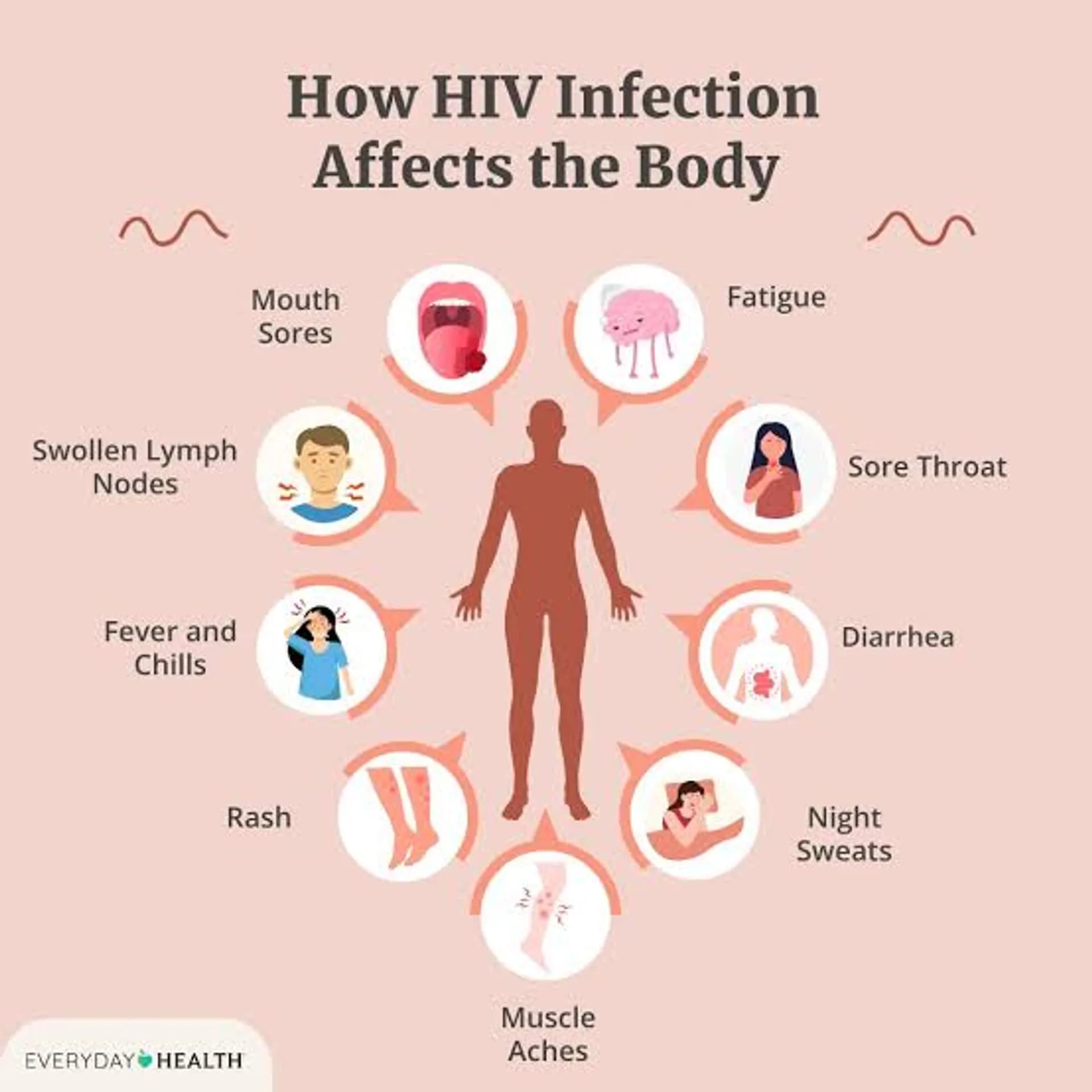 Early sigs of HIV