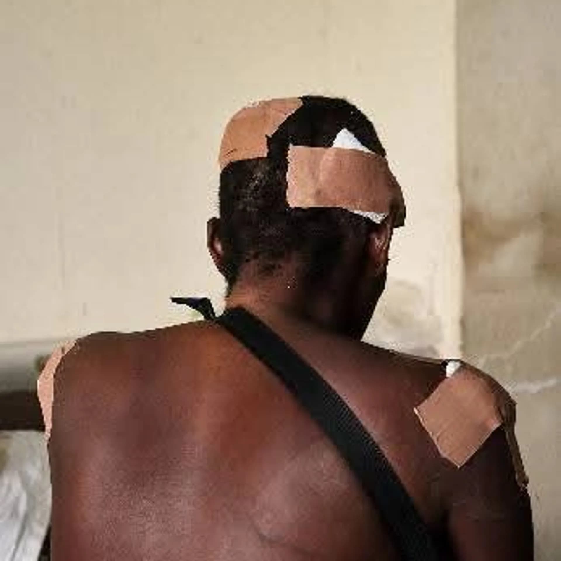 Ikwo Man Hospitalised After Alleged Armed Attack in Oso Edda, Motorcycle Stolen by Oso Edda Youths